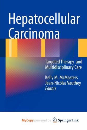 Hepatocellular Carcinoma : - Kelly M. McMasters