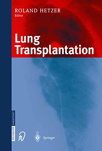 -Lung transplantation