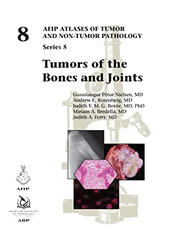 Tumors of the Bones and Joints - Gunnlaugur Pétur Nielsen