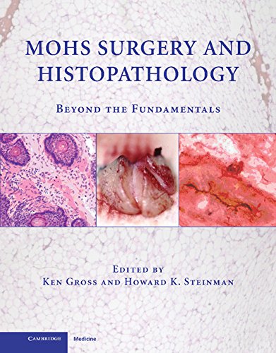 Kenneth G.  Gross-Histopathology in Mohs surgery