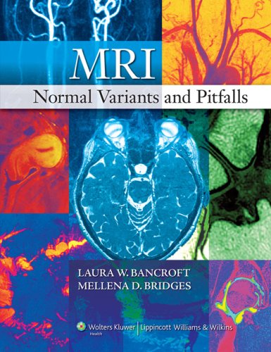 Laura W. Bancroft-MRI normal variants and pitfalls