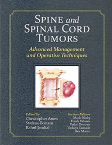 Christopher Ames-Spine and Spinal Cord Tumors
