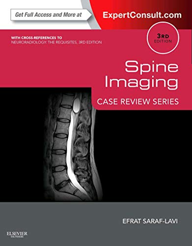 Efrat Saraf-Lavi-Spine Imaging Case Review