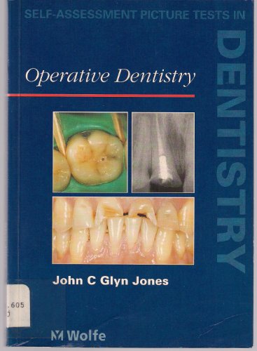 Operative dentistry - John Glyn Jones