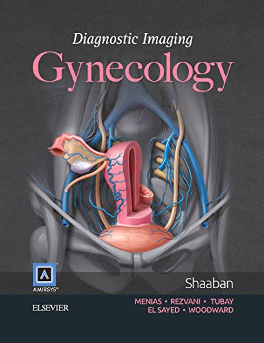 Gynecology - Akram A. Shaaban