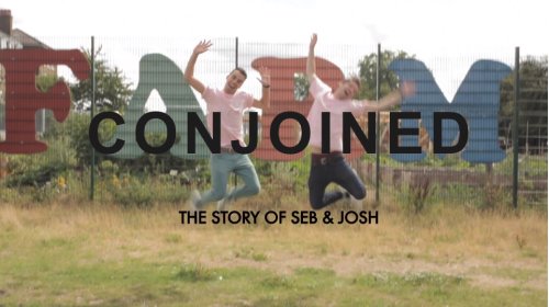 Conjoined: The Story of Seb and Josh (2015)